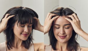 Caída de cabello: Conoce sus causas y un tratamiento