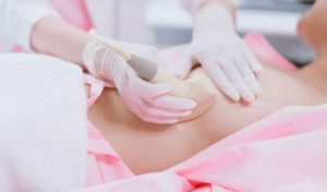 El impacto de la detección tardía del cáncer de mama en el Perú