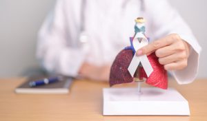 El cáncer de pulmón, una amenaza creciente en adultos jóvenes